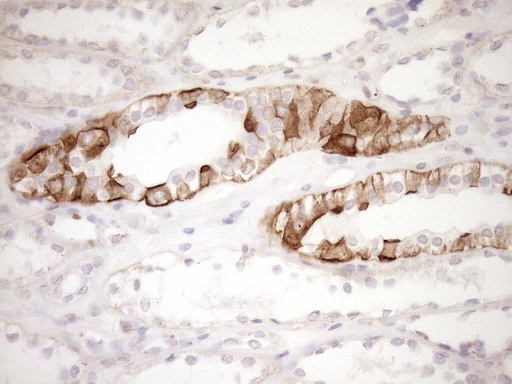 EPLIN Antibody - Immunohistochemical staining of paraffin-embedded Human Kidney tissue within the normal limits using anti-LIMA1 mouse monoclonal antibody. (Heat-induced epitope retrieval by 1mM EDTA in 10mM Tris buffer. (pH8.5) at 120°C for 3 min. (1:150)