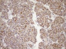 EPLIN Antibody - Immunohistochemical staining of paraffin-embedded Human pancreas tissue within the normal limits using anti-LIMA1 mouse monoclonal antibody. (Heat-induced epitope retrieval by 1mM EDTA in 10mM Tris buffer. (pH8.5) at 120°C for 3 min. (1:150)