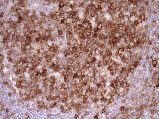 EPLIN Antibody - Immunohistochemical staining of paraffin-embedded Human tonsil within the normal limits using anti-LIMA1 mouse monoclonal antibody. (Heat-induced epitope retrieval by 1mM EDTA in 10mM Tris buffer. (pH8.5) at 120°C for 3 min. (1:150)