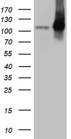 EPLIN Antibody - HEK293T cells were transfected with the pCMV6-ENTRY control. (Left lane) or pCMV6-ENTRY LIMA1. (Right lane) cDNA for 48 hrs and lysed. Equivalent amounts of cell lysates. (5 ug per lane) were separated by SDS-PAGE and immunoblotted with anti-LIMA1. (1:2000)