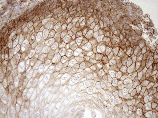 EPLIN Antibody - Immunohistochemical staining of paraffin-embedded Human tonsil within the normal limits using anti-LIMA1 mouse monoclonal antibody. (Heat-induced epitope retrieval by 1mM EDTA in 10mM Tris buffer. (pH8.5) at 120°C for 3 min. (1:150)