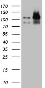 EPLIN Antibody - HEK293T cells were transfected with the pCMV6-ENTRY control. (Left lane) or pCMV6-ENTRY LIMA1. (Right lane) cDNA for 48 hrs and lysed