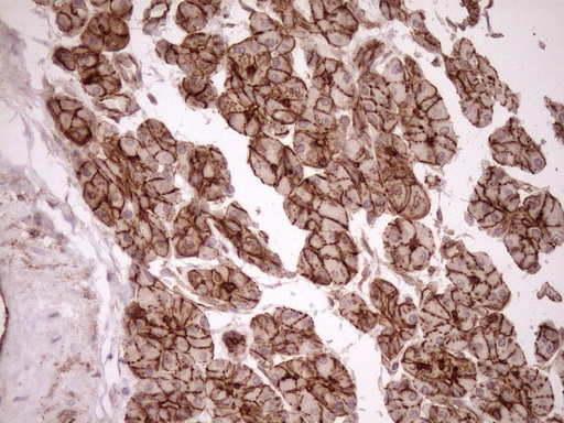 EPLIN Antibody - Immunohistochemical staining of paraffin-embedded Human pancreas tissue within the normal limits using anti-LIMA1 mouse monoclonal antibody. (Heat-induced epitope retrieval by 1mM EDTA in 10mM Tris buffer. (pH8.5) at 120°C for 3 min. (1:150)