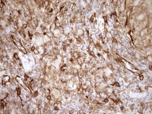 EPLIN Antibody - Immunohistochemical staining of paraffin-embedded Human lymph node tissue within the normal limits using anti-LIMA1 mouse monoclonal antibody. (Heat-induced epitope retrieval by 1mM EDTA in 10mM Tris buffer. (pH8.5) at 120°C for 3 min. (1:150)