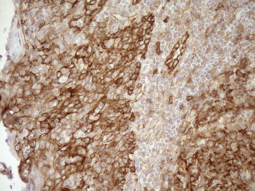 EPLIN Antibody - Immunohistochemical staining of paraffin-embedded Human tonsil within the normal limits using anti-LIMA1 mouse monoclonal antibody. (Heat-induced epitope retrieval by 1mM EDTA in 10mM Tris buffer. (pH8.5) at 120°C for 3 min. (1:150)