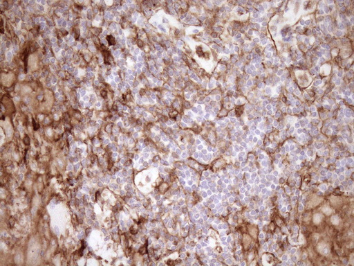EPLIN Antibody - Immunohistochemical staining of paraffin-embedded Human lymph node tissue within the normal limits using anti-LIMA1 mouse monoclonal antibody. (Heat-induced epitope retrieval by 1mM EDTA in 10mM Tris buffer. (pH8.5) at 120°C for 3 min. (1:150)