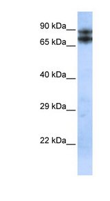 EPLIN Antibody - LIMA1 / EPLIN antibody Western blot of Placenta lysate. This image was taken for the unconjugated form of this product. Other forms have not been tested.