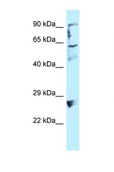 EPLIN Antibody - LIMA1 / EPLIN antibody Western blot of COL0205 Cell lysate. Antibody concentration 1 ug/ml. This image was taken for the unconjugated form of this product. Other forms have not been tested.