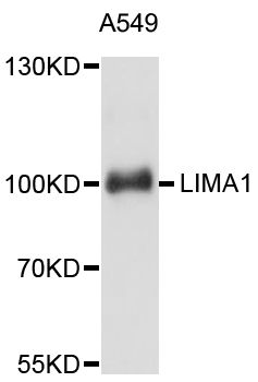 EPLIN Antibody - Western blot analysis of extracts of A-549 cells, using LIMA1 antibody at 1:3000 dilution. The secondary antibody used was an HRP Goat Anti-Rabbit IgG (H+L) at 1:10000 dilution. Lysates were loaded 25ug per lane and 3% nonfat dry milk in TBST was used for blocking. An ECL Kit was used for detection and the exposure time was 10s.