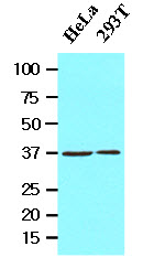 EPM2A / Laforin Antibody - Cell lysates of HeLa and 293T (20 ug) were resolved by SDS-PAGE, transferred to NC membrane and probed with anti-human EPM2A (1:1000). Proteins were visualized using a goat anti-mouse secondary antibody conjugated to HRP and an ECL detection system.