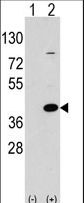 EPM2A / Laforin Antibody - Western blot of EPM2A (arrow) using rabbit polyclonal EPM2A Antibody. 293 cell lysates (2 ug/lane) either nontransfected (Lane 1) or transiently transfected with the EPM2A gene (Lane 2) (Origene Technologies).