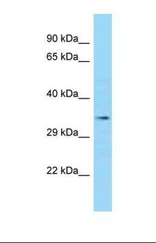 EPM2A / Laforin Antibody - Western blot of Human THP-1 . EPM2A antibody dilution 1.0 ug/ml.  This image was taken for the unconjugated form of this product. Other forms have not been tested.