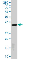 EPM2A / Laforin Antibody - EPM2A monoclonal antibody (M01), clone 4A12. Western blot of EPM2A expression in PC-12.