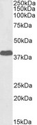 EPM2A / Laforin Antibody - Biotinylated antibody (1µg/ml) staining of Human Cerebellum lysate (35µg protein in RIPA buffer), exactly mirroring its parental non-biotinylated product. Primary incubation was 1 hour. Detected by chemiluminescence, using streptavidin-HRP and using NAP bl