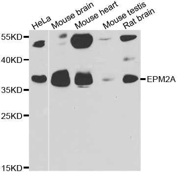 EPM2A / Laforin Antibody - Western blot analysis of extracts of various cell lines.