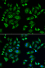 EPM2A / Laforin Antibody - Immunofluorescence analysis of A549 cells.