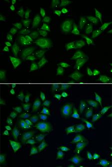 EPM2A / Laforin Antibody - Immunofluorescence analysis of A549 cells.