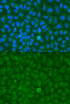 EPM2A / Laforin Antibody - Immunofluorescence analysis of HeLa cells.