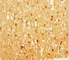 EPM2A / Laforin Antibody - Immunohistochemistry of paraffin-embedded human brain tissue at dilution 1:100