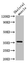 EPM2A / Laforin Antibody - Western Blot Positive WB detected in:Mouse skeletal muscle tissue All Lanes: EPM2A antibody at 3ug/ml Secondary Goat polyclonal to rabbit IgG at 1/50000 dilution Predicted band size: 36 kDa Observed band size: 36 kDa