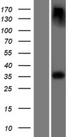 EPM2A / Laforin Protein - Western validation with an anti-DDK antibody * L: Control HEK293 lysate R: Over-expression lysate