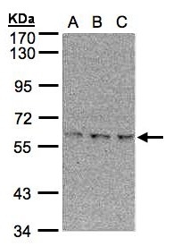 EPM2AIP1 Antibody - Sample (30 ug of whole cell lysate). A:293T, B: A431, C: H1299. 7.5% SDS PAGE. EPM2AIP1 antibody diluted at 1:500