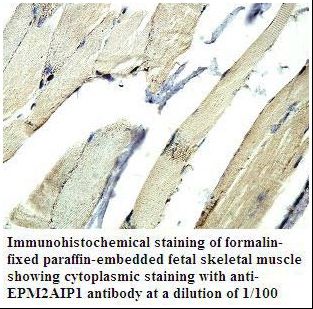 EPM2AIP1 Antibody