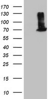 EPM2AIP1 Antibody - HEK293T cells were transfected with the pCMV6-ENTRY control (Left lane) or pCMV6-ENTRY EPM2AIP1 (Right lane) cDNA for 48 hrs and lysed. Equivalent amounts of cell lysates (5 ug per lane) were separated by SDS-PAGE and immunoblotted with anti-EPM2AIP1.