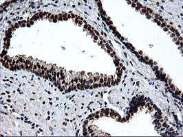 EPM2AIP1 Antibody - IHC of paraffin-embedded Human prostate tissue using anti-EPM2AIP1 mouse monoclonal antibody.