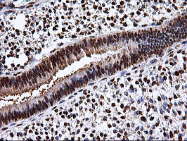 EPM2AIP1 Antibody - IHC of paraffin-embedded Human endometrium tissue using anti-EPM2AIP1 mouse monoclonal antibody.