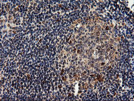 EPM2AIP1 Antibody - IHC of paraffin-embedded Human tonsil using anti-EPM2AIP1 mouse monoclonal antibody.