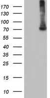 EPM2AIP1 Antibody - HEK293T cells were transfected with the pCMV6-ENTRY control (Left lane) or pCMV6-ENTRY EPM2AIP1 (Right lane) cDNA for 48 hrs and lysed. Equivalent amounts of cell lysates (5 ug per lane) were separated by SDS-PAGE and immunoblotted with anti-EPM2AIP1.