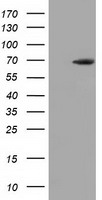 EPM2AIP1 Antibody - HEK293T cells were transfected with the pCMV6-ENTRY control (Left lane) or pCMV6-ENTRY EPM2AIP1 (Right lane) cDNA for 48 hrs and lysed. Equivalent amounts of cell lysates (5 ug per lane) were separated by SDS-PAGE and immunoblotted with anti-EPM2AIP1.