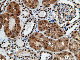 EPM2AIP1 Antibody - IHC of paraffin-embedded Human Kidney tissue using anti-EPM2AIP1 mouse monoclonal antibody.