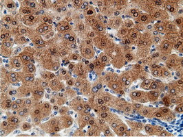 EPM2AIP1 Antibody - IHC of paraffin-embedded Human liver tissue using anti-EPM2AIP1 mouse monoclonal antibody.