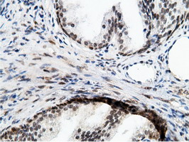 EPM2AIP1 Antibody - IHC of paraffin-embedded Human prostate tissue using anti-EPM2AIP1 mouse monoclonal antibody.