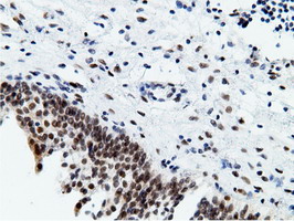 EPM2AIP1 Antibody - IHC of paraffin-embedded Human bladder tissue using anti-EPM2AIP1 mouse monoclonal antibody.
