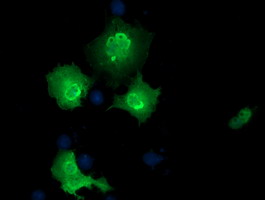 EPM2AIP1 Antibody - Anti-EPM2AIP1 mouse monoclonal antibody  immunofluorescent staining of COS7 cells transiently transfected by pCMV6-ENTRY EPM2AIP1.