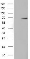 EPM2AIP1 Antibody - HEK293T cells were transfected with the pCMV6-ENTRY control (Left lane) or pCMV6-ENTRY EPM2AIP1 (Right lane) cDNA for 48 hrs and lysed. Equivalent amounts of cell lysates (5 ug per lane) were separated by SDS-PAGE and immunoblotted with anti-EPM2AIP1.
