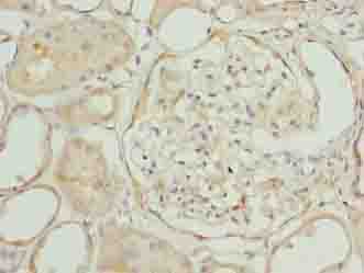 EPM2AIP1 Antibody - Immunohistochemistry of paraffin-embedded human kidney tissue using antibody at dilution of 1:100.