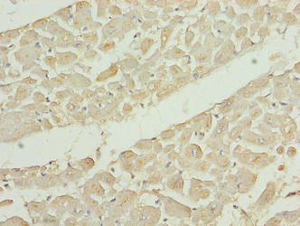 EPM2AIP1 Antibody - Immunohistochemistry of paraffin-embedded human heart tissue using EPM2AIP1 Antibody at dilution of 1:100