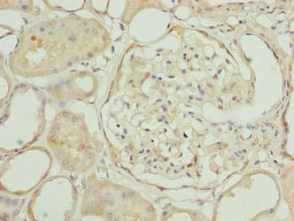 EPM2AIP1 Antibody - Immunohistochemistry of paraffin-embedded human kidney tissue using EPM2AIP1 Antibody at dilution of 1:100