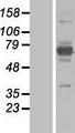 EPM2AIP1 Protein - Western validation with an anti-DDK antibody * L: Control HEK293 lysate R: Over-expression lysate