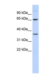 EPN2 Antibody - EPN2 antibody Western blot of 293T cell lysate. This image was taken for the unconjugated form of this product. Other forms have not been tested.