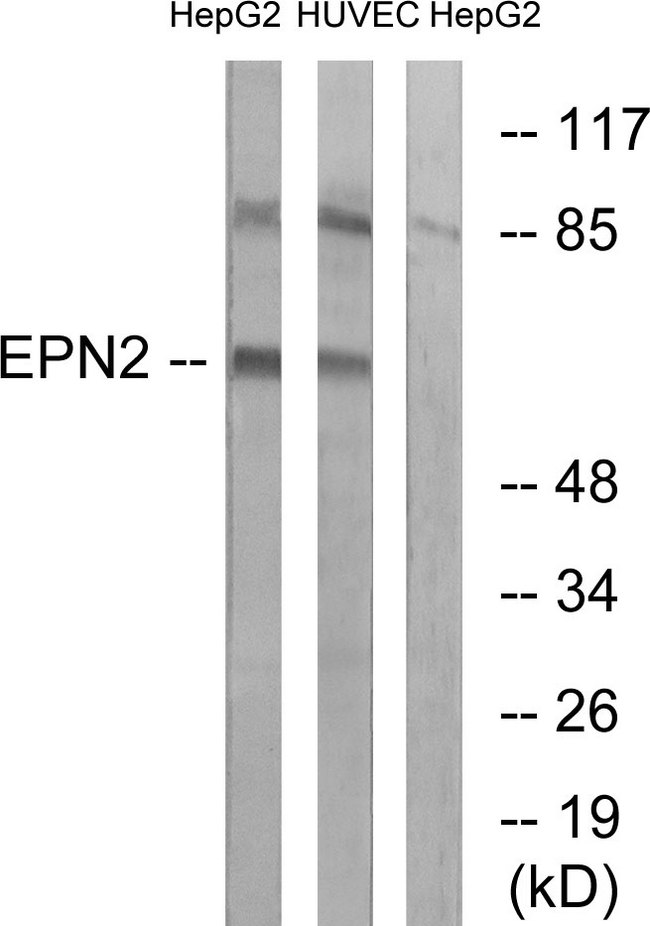 EPN2 Antibody - Western blot analysis of lysates from HepG2 and HUVEC cells, using EPN2 Antibody. The lane on the right is blocked with the synthesized peptide.