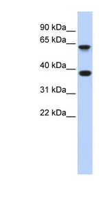 EPN2 Antibody - EPN2 antibody Western blot of Fetal Brain lysate. This image was taken for the unconjugated form of this product. Other forms have not been tested.