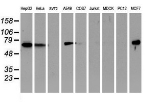 EPN2 Antibody - Western blot of extracts (35 ug) from 9 different cell lines by using anti-EPN2 monoclonal antibody.