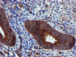EPN2 Antibody - IHC of paraffin-embedded Human endometrium tissue using anti-EPN2 mouse monoclonal antibody.