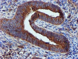 EPN2 Antibody - IHC of paraffin-embedded Human endometrium tissue using anti-EPN2 mouse monoclonal antibody.