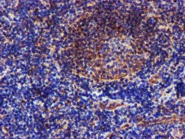 EPN2 Antibody - IHC of paraffin-embedded Human tonsil using anti-EPN2 mouse monoclonal antibody.
